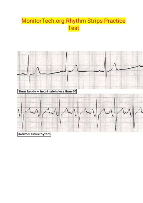 Relias Advanced Dysrhythmia Clinical Assessment MonitorTech.org Rhythm Strips Practice Test ...