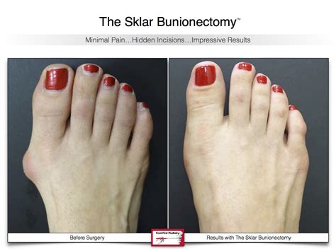 Our Blog — Foot First Podiatry Centers