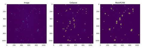 Image result for Amira Cell Segmentation Tutorial