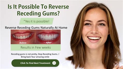 Can Gum Recession Be Reversed