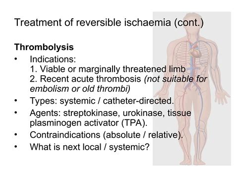 Acute Limb Ischemia - embolectomy, endovascular treatment, hybrid therapy, thrombolysis | PPT