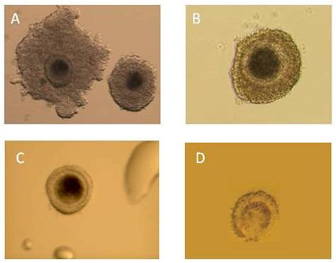 L-OPU in Goat and Sheep—Different Variants of the Oocyte Recovery Method