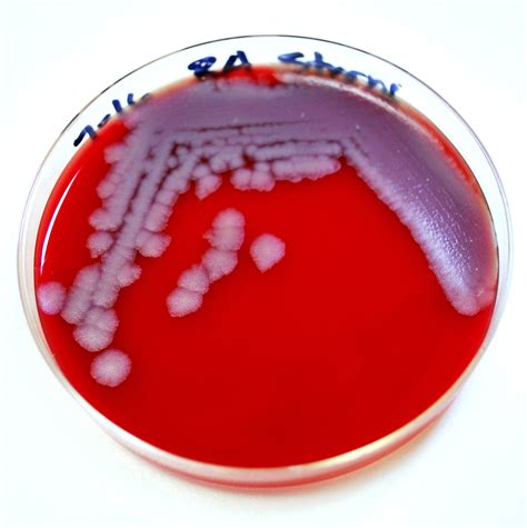 Image libre: anthrax, la propagation, une, personne, personne, anthracis, spores, vivre, le sol ...
