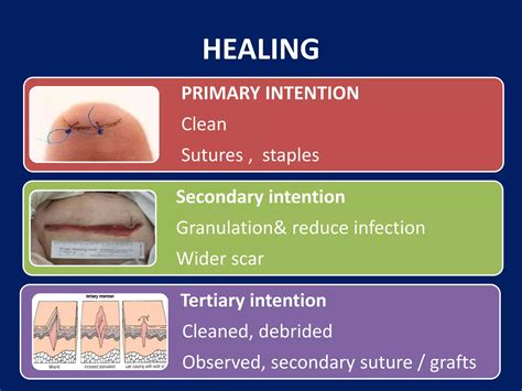 Wound care essentials | PPTX