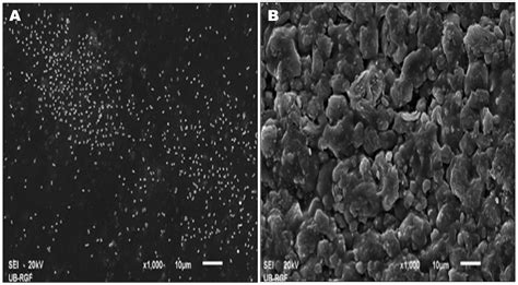 Nanoparticles for Control of Biofilms of Acinetobacter Species