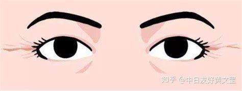 眼部的眼角皱纹怎么去除 为你减低肌肤衰老方法-时尚前沿-温哥华港湾（电脑版）