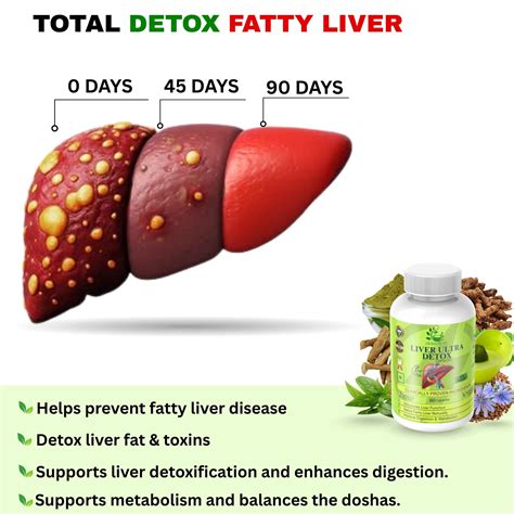 Liver Ultra detox - Best Ayurvedic medicine for fatty liver (Grade 1 ...