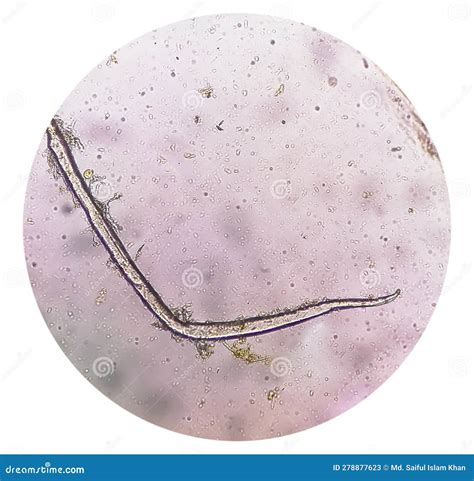 What Is Microscopic Examination Of Stool at Sharon Russell blog
