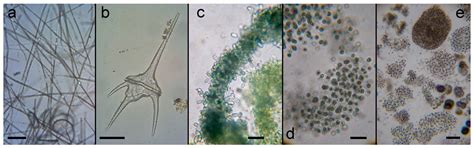 Phytoplankton Diversity, Abundance and Toxin Synthesis Potential in the ...