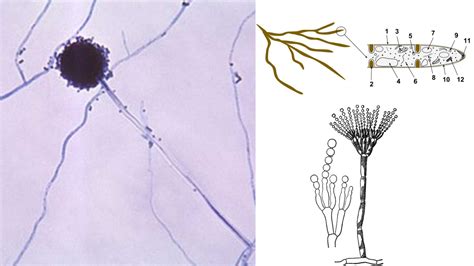 Rhizopus sporangia - Overview - Biology Notes Online