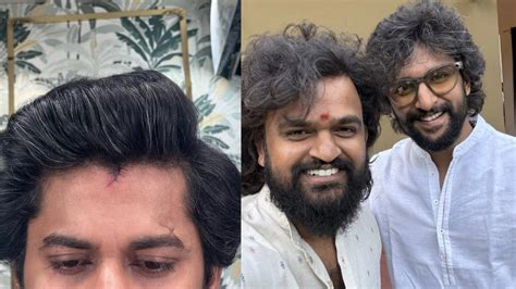 Sailesh Kolanu : హిట్ 3 షూటింగ్ లో నాని తలకు గాయం.. రక్తం కారినా ...