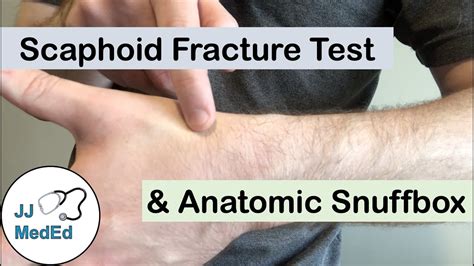 Scaphoid Fracture Test 的图像结果