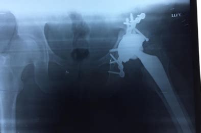 Amogh Ortho Center