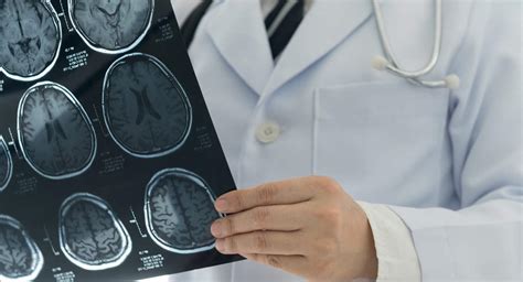medical insurance: Non-Covid health claims rise as deferred treatments ...