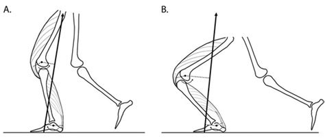 Sensory-Motor Mechanisms Increasing Falls Risk in Diabetic Peripheral ...