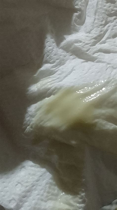 Flujo amarillo verdoso | BabyCenter