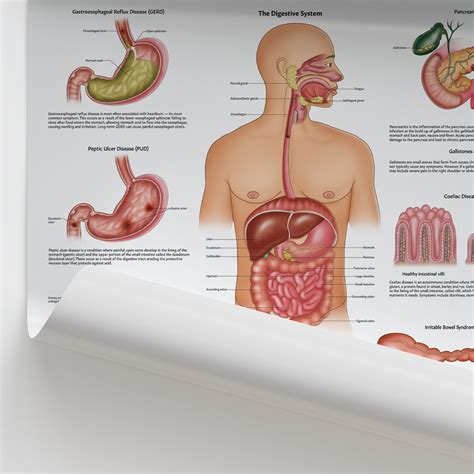 Digestive System Diseases 的图像结果