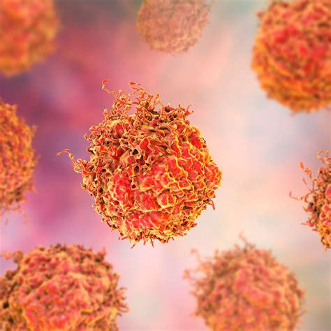 Molekularpathologische Diagnostik beim fortgeschrittenen Prostatakarzi ...