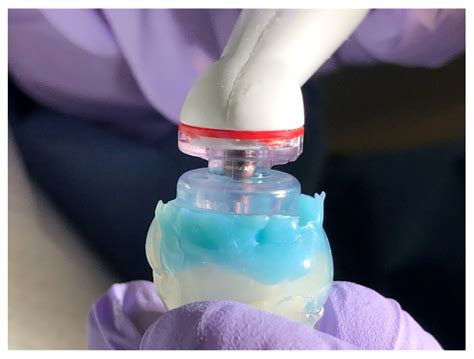 Histological Evaluation of Multisonic Technology for Debridement of ...