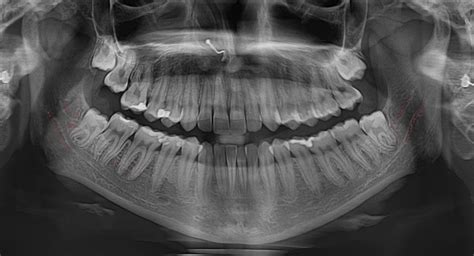 2 things I wish I knew 8 years ago while administering Inferior ...