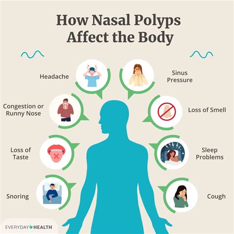 6 Habits to Avoid if You Have Nasal Polyps