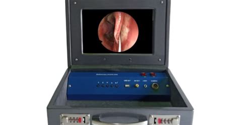 VIOLK Endoscopy Mobile Unit- HD IPS Display (Dark Gray)