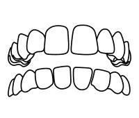 Park Dental Care – Hyderabad’s Trusted Dental Clinic Near KBR Park ...