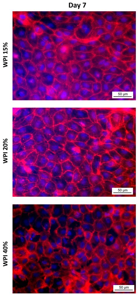 Endothelialization of Whey Protein Isolate-Based Scaffolds for Tissue ...