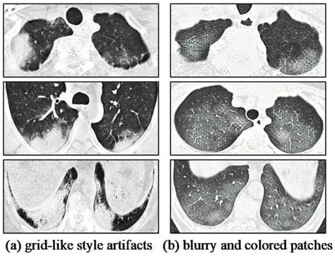 Diverse COVID-19 CT Image-to-Image Translation with Stacked Residual ...