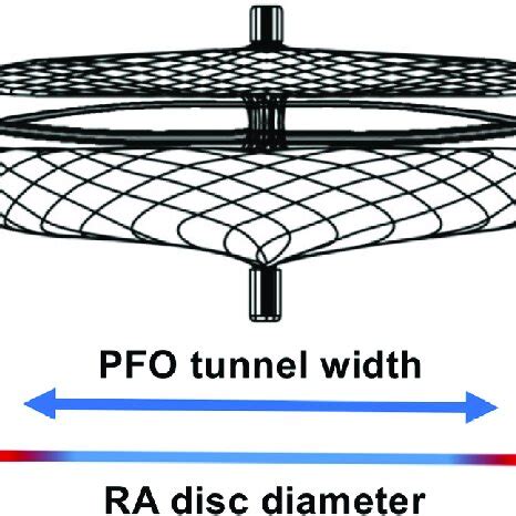 PFO Defect 的图像结果