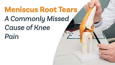 Meniscus Root Tears – A Commonly Missed Cause of Knee Pain