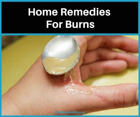 home remedy 3rd degree burn