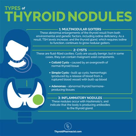 Weight Gain With Thyroid Nodules at Gabrielle Miller blog
