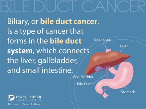 What Is Biliary Cancer? | Dana-Farber Cancer Institute