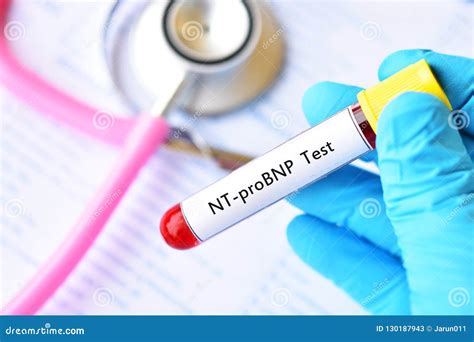 Blood Sample For NT-proBNP Test Royalty-Free Stock Photo | CartoonDealer.com #130187943