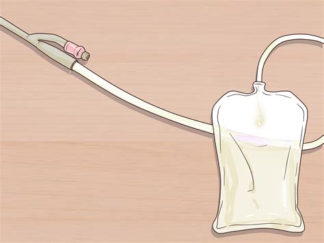 How to Irrigate a Foley Catheter (with Pictures) - wikiHow