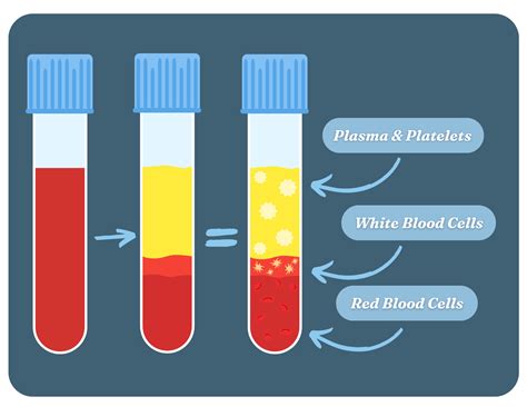 Injectable PRF 的图像结果