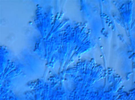 Penicillium Under Microscope