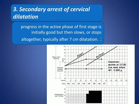 PPT - Abnormal Labor: Diagnosis and Management PowerPoint Presentation ...