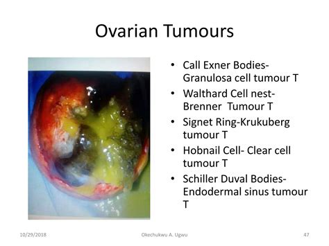 100 picture osce in obstetrics and gynaecology | PPTX