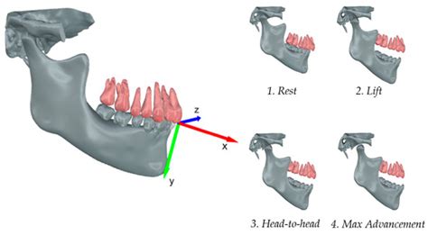 A Procedure for Analyzing Mandible Roto-Translation Induced by ...