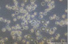 tappeto di emazie leucocytes michele rotunno tappeto di emazie leucocytes michele rotunno