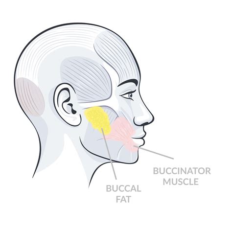 Buccal Fat Removal: Dr Yannis Debunks