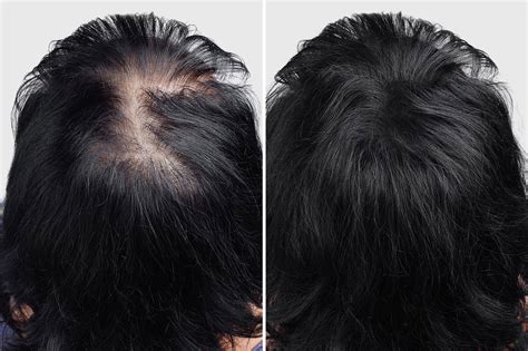 Image result for Reconstructing