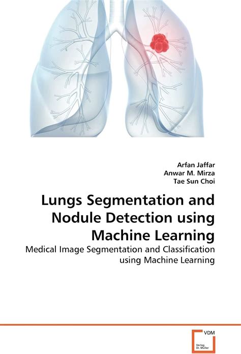 Lungs Segmentation And Nodule Detection Using Machine Learning Medical ...