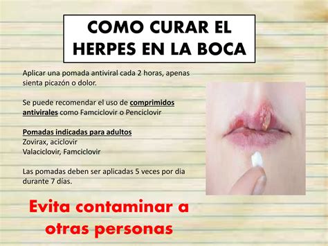 Como curar el herpes labial | PPTX