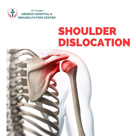 Shoulder Dislocation: Causes, Symptoms, and Treatment | Expert Orthopedic Care in Pimpri Chinchwad