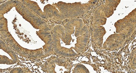 PPM1F antibody (17020-1-AP) | Proteintech