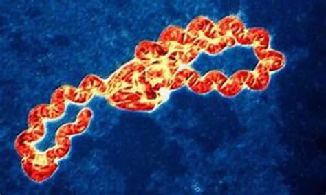 Leptospirosis: A Bacterial Infection with Flu-Like Symptoms, Can Be ...
