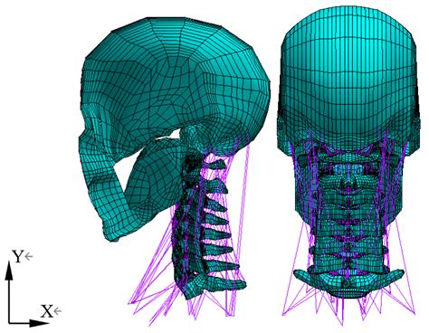 Finite Element Analysis of Cervical Spine Kinematic Response during ...